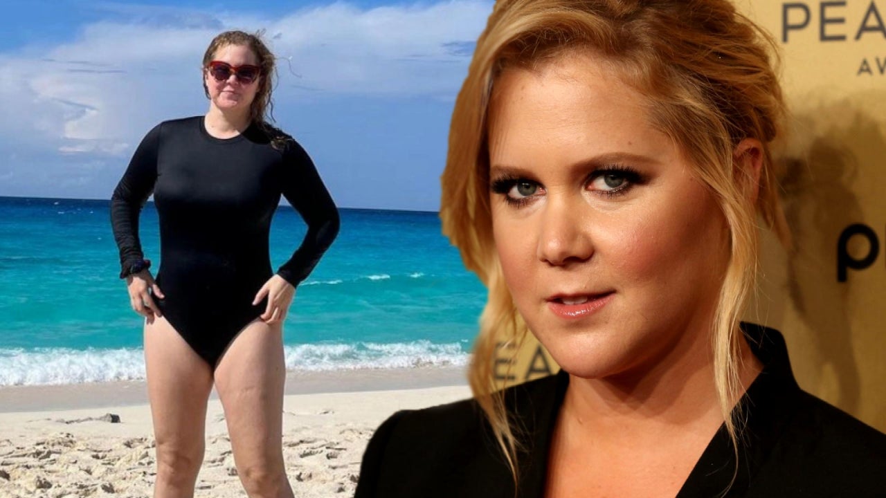 Amy Schumer Shares Health Update After Undergoing Endometriosis Surgery Liposuction 